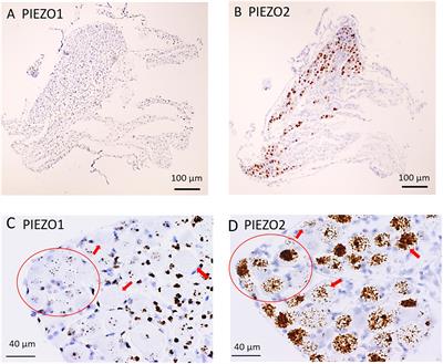 PIEZO1 Is Selectively Expressed in Small Diameter Mouse DRG Neurons Distinct From Neurons Strongly Expressing TRPV1